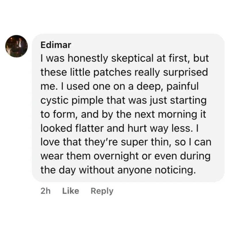 omma cystic pimple review