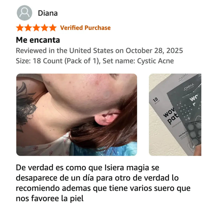 omma cystic acne review