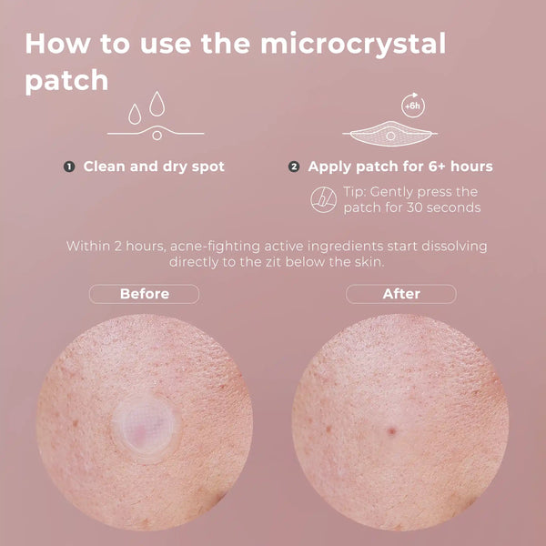 wow patch: blemish patch kit
