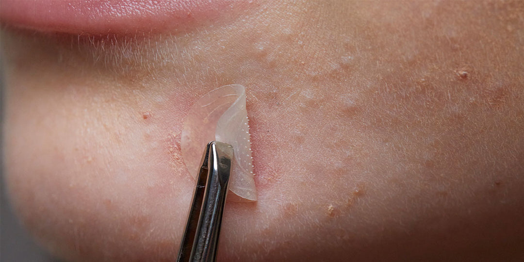 Do Pimple Patches Work Find Out The Science Behind Them Omma Cosmetics