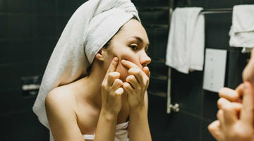 The Pimple Puzzle Solved: Understanding the Different Types of Pimples and How to Treat Them