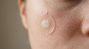 How Do Pimple Patches Pull Gunk Out? The Science