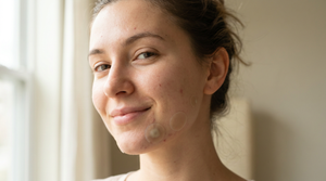 Can a Pimple Patch Pull Out a Cyst? The Truth