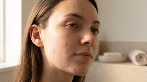 Complete Guide to Blemish & Pimple Treatment Stickers 2026