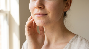 Chin Acne Causes in Females: Real Triggers 2026