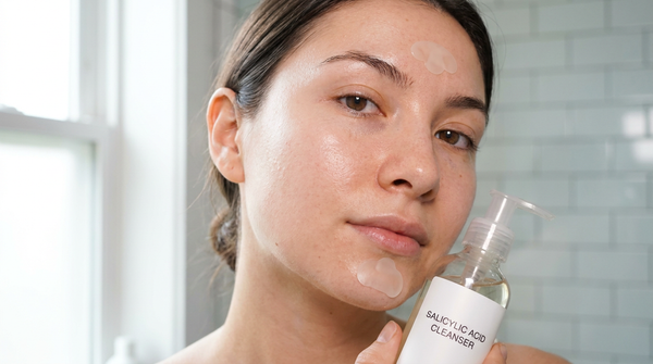 Salicylic Acid Cleanser vs Patches: Why Both Matter 2026