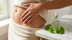Centella Asiatica for Stretch Marks: Does It Work?