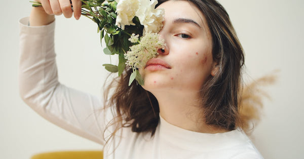 Alternative Remedies for Cystic Acne That Actually Work