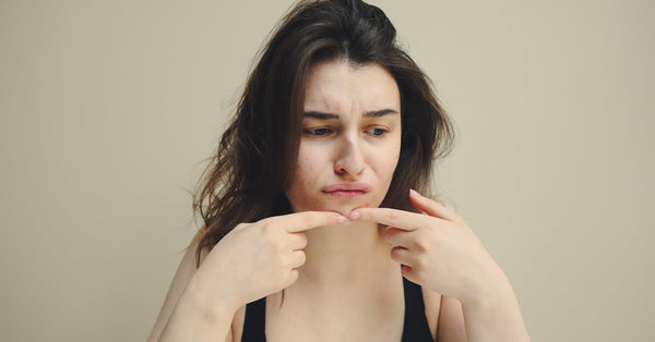 How Do You Get Rid of Cystic Acne? Expert Tips That Work