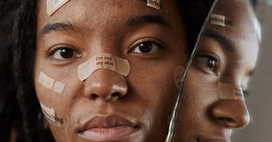 Cystic Acne Timing Explained with Photos and Healing Stages