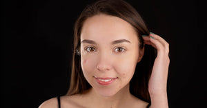 Cystic Acne Scars: How to Treat and Prevent Them