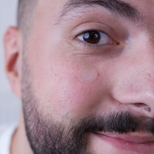 wow patch: microcrystal blemish patch