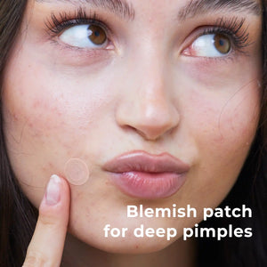 wow patch: microcrystal blemish patch