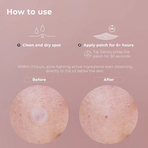 wow patch: microcrystal blemish patch