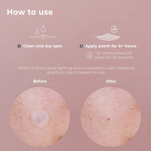 wow patch: microcrystal blemish patch