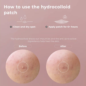 wow patch: blemish patch kit