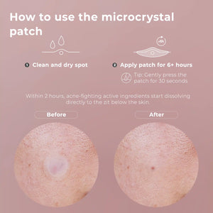 wow patch: blemish patch kit