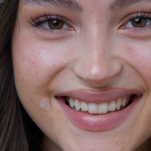 wow patch:  invisible hydrocolloid blemish patch