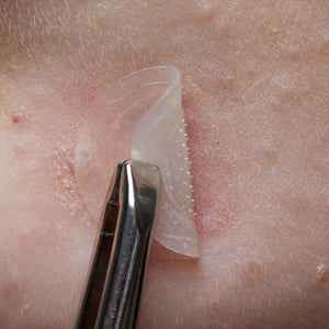 wow patch: microcrystal blemish patch