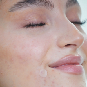 wow patch:  invisible hydrocolloid blemish patch